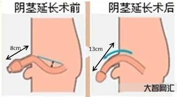 陰莖是怎么樣子的圖片欣賞