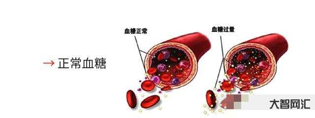 血糖高的癥狀有哪些癥狀-糖尿病患者注意:判斷自己病情是否加重，這4個信