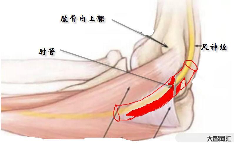 雷特綜合癥是什么癥狀-運動訓練或可減輕罕見病雷特綜合征癥狀